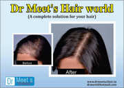Experienced Trichologist For Best Hair Treatment