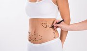 Best Liposuction Clinic in Indore