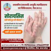 Best psoriasis treatment - Government Ayurveda College and Hospital
