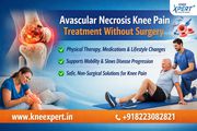 Avascular Necrosis Knee Pain Treatment Without Surgery – Knee Xpert